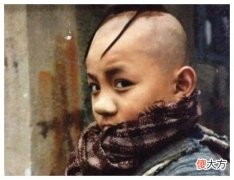 有种“逆袭”叫三毛，植发后帅到认不出，头发多少太影响颜值高低