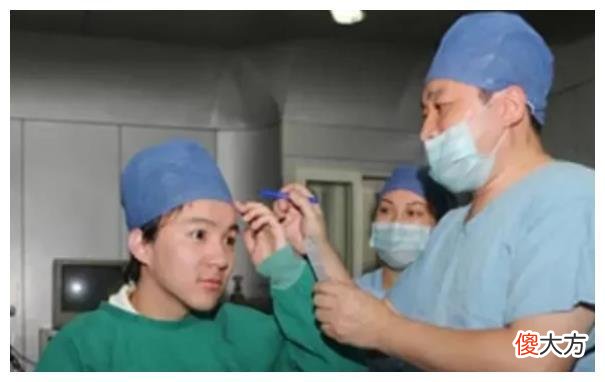 有种“逆袭”叫三毛,植发后帅到认不出,头发多少太影响颜值高低