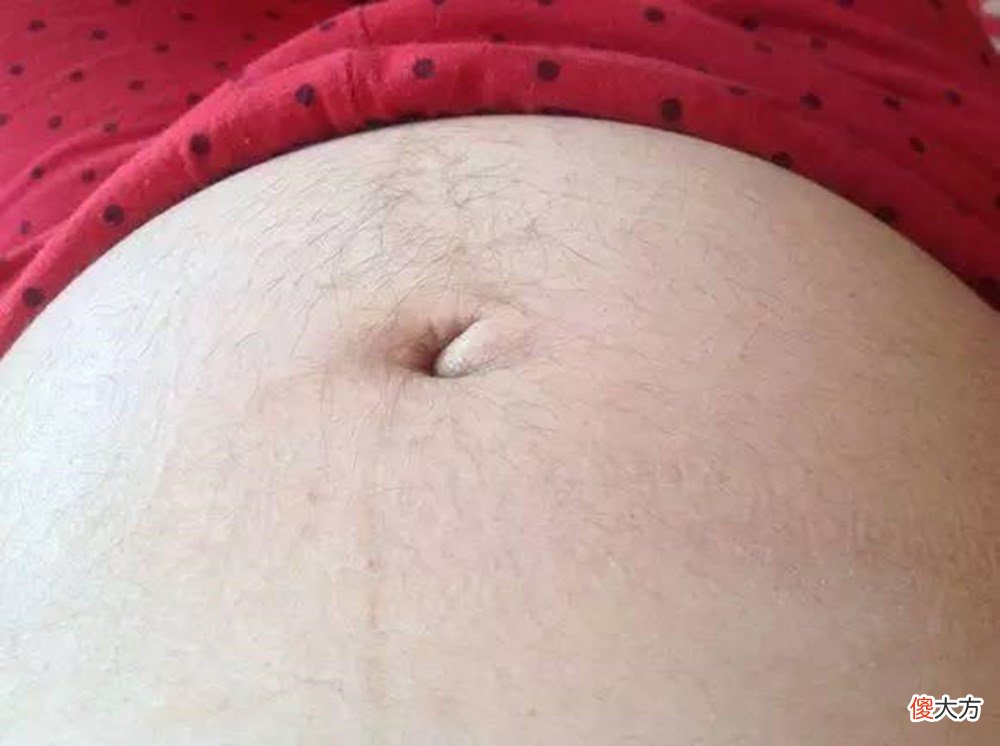 女人怀孕后，肚子上为什么会“长毛”？正解在这里
