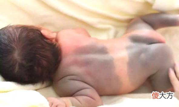 为何新生宝宝屁股上都有“青痕”？你知道是怎么来的吗？