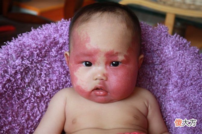 为何新生宝宝屁股上都有“青痕”？你知道是怎么来的吗？