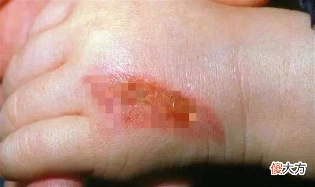 这种保温杯，一不小心就变“喷水杯”，家长如何预防孩子被烫伤？