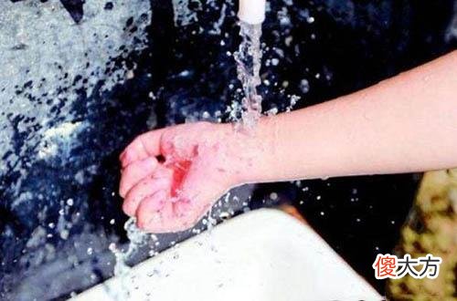 这种保温杯，一不小心就变“喷水杯”，家长如何预防孩子被烫伤？