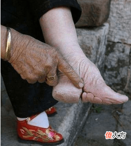 【历史故事】古人为什么会让女子受到如此毫无意义的裹脚摧残呢
