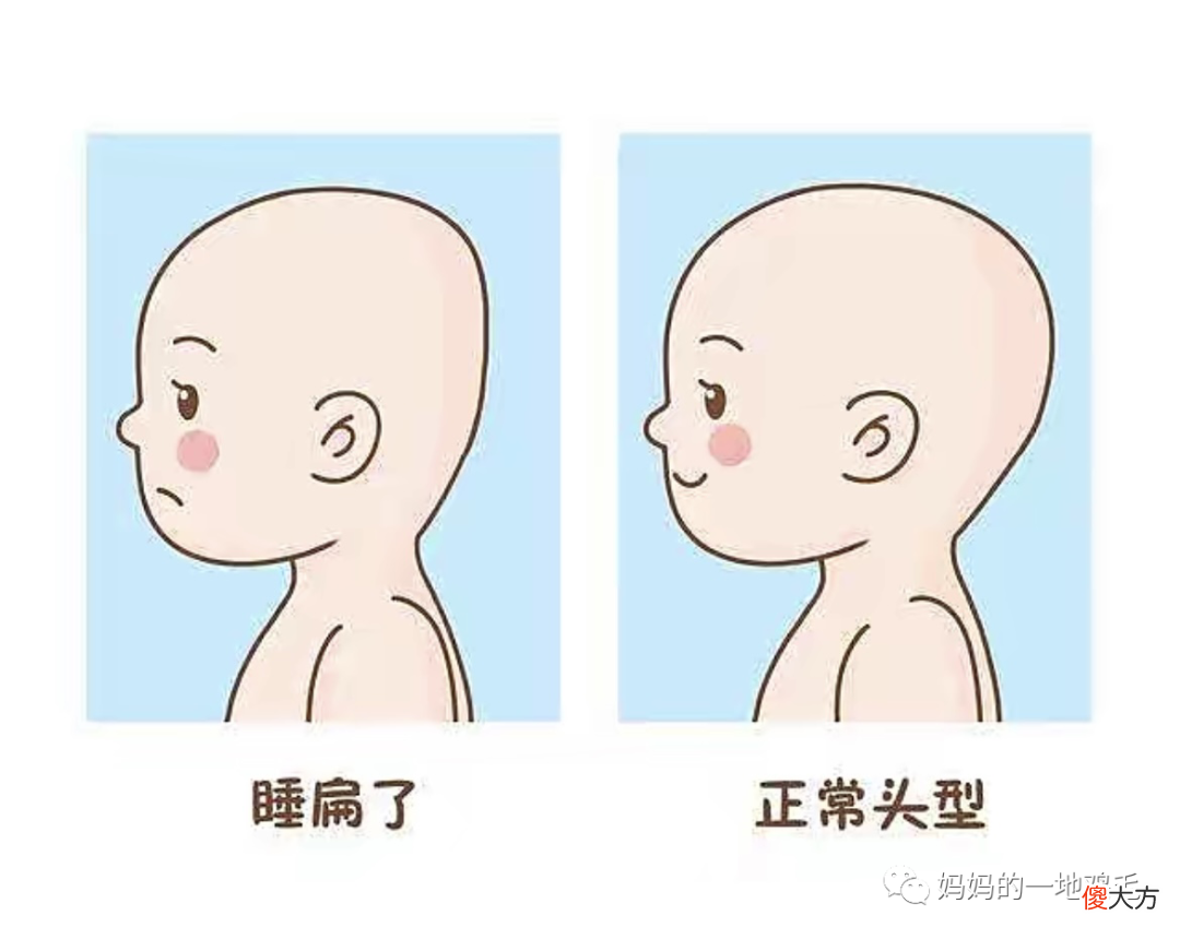 宝宝扁头影响大脑发育吗?