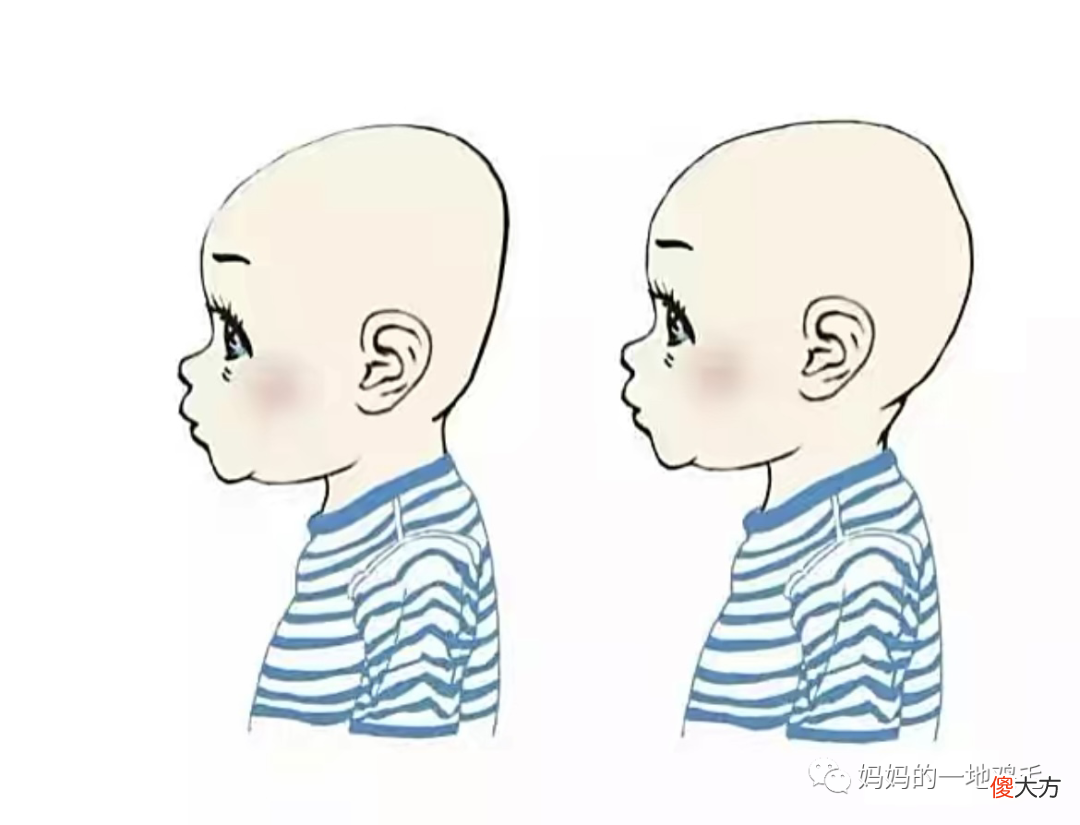 宝宝扁头影响大脑发育吗?