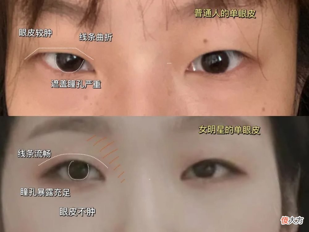 【就爱时尚】单眼皮、泪沟、凸嘴、方腮等，才是“小美女”的重中之重