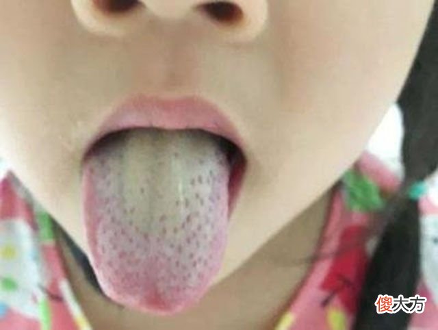 孩子个子体重不达标？孩子积食有问题，每周一次这汤水，强健脾胃
