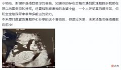 【游戏迷】LNG选手Doinb官宣当爹 又一位竞二代要来了