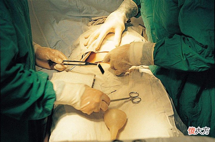 宝妈吐槽分娩时的尴尬:头胎顺产被“剃毛”,二胎剖腹产也没逃掉