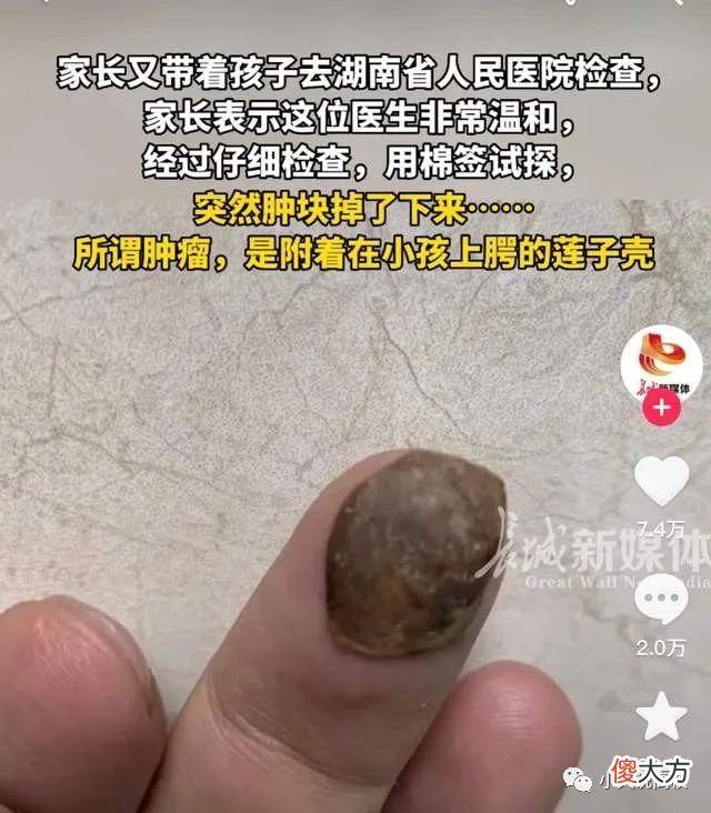 丢人现眼!湘雅医院把孩子嘴里莲子壳诊断为肿瘤,要求住院切除