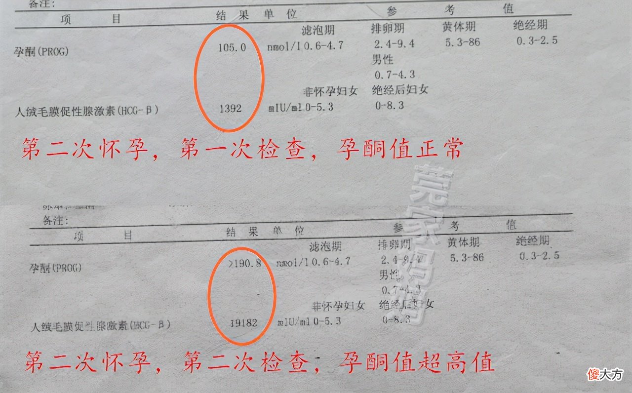 盘点怀孕生娃时交过的“智商税”，希望你别中招，孕妈要“避坑”