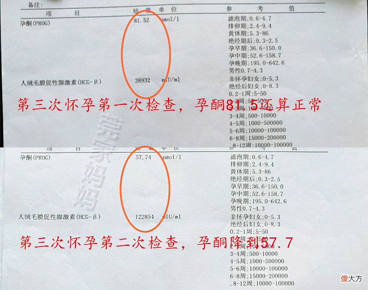 盘点怀孕生娃时交过的“智商税”，希望你别中招，孕妈要“避坑”