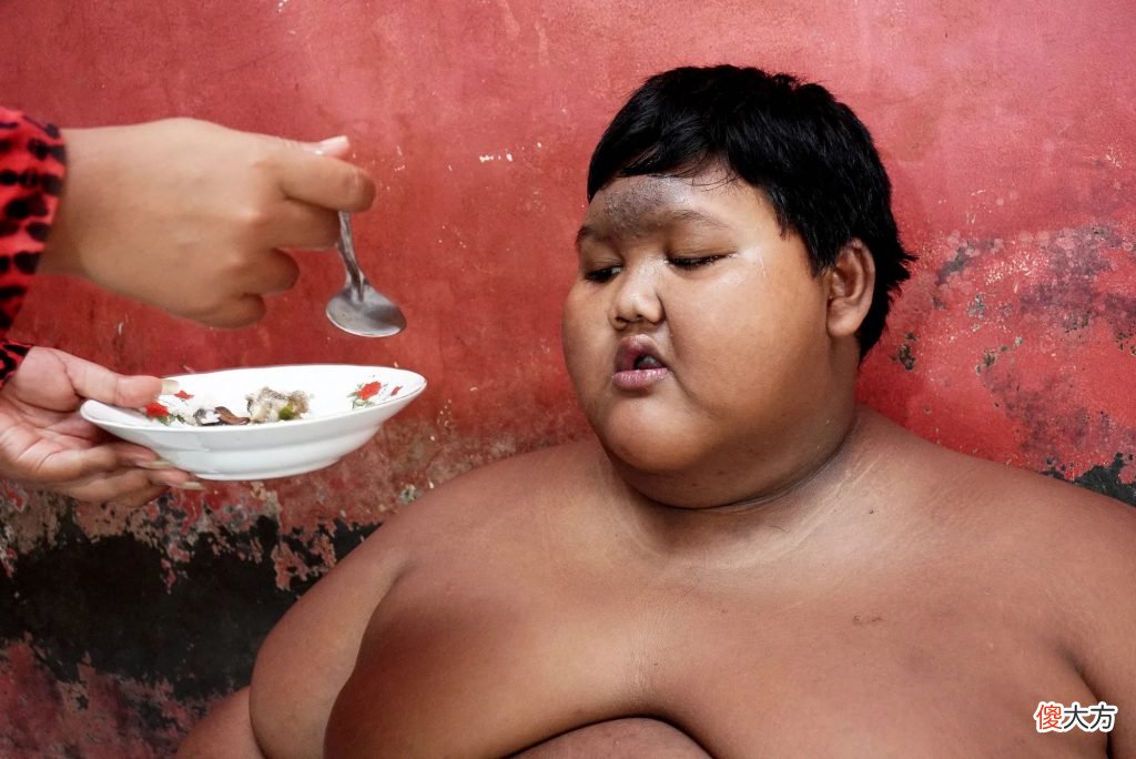 世界上最独特的8个孩子,愿他们都能成为人间天使