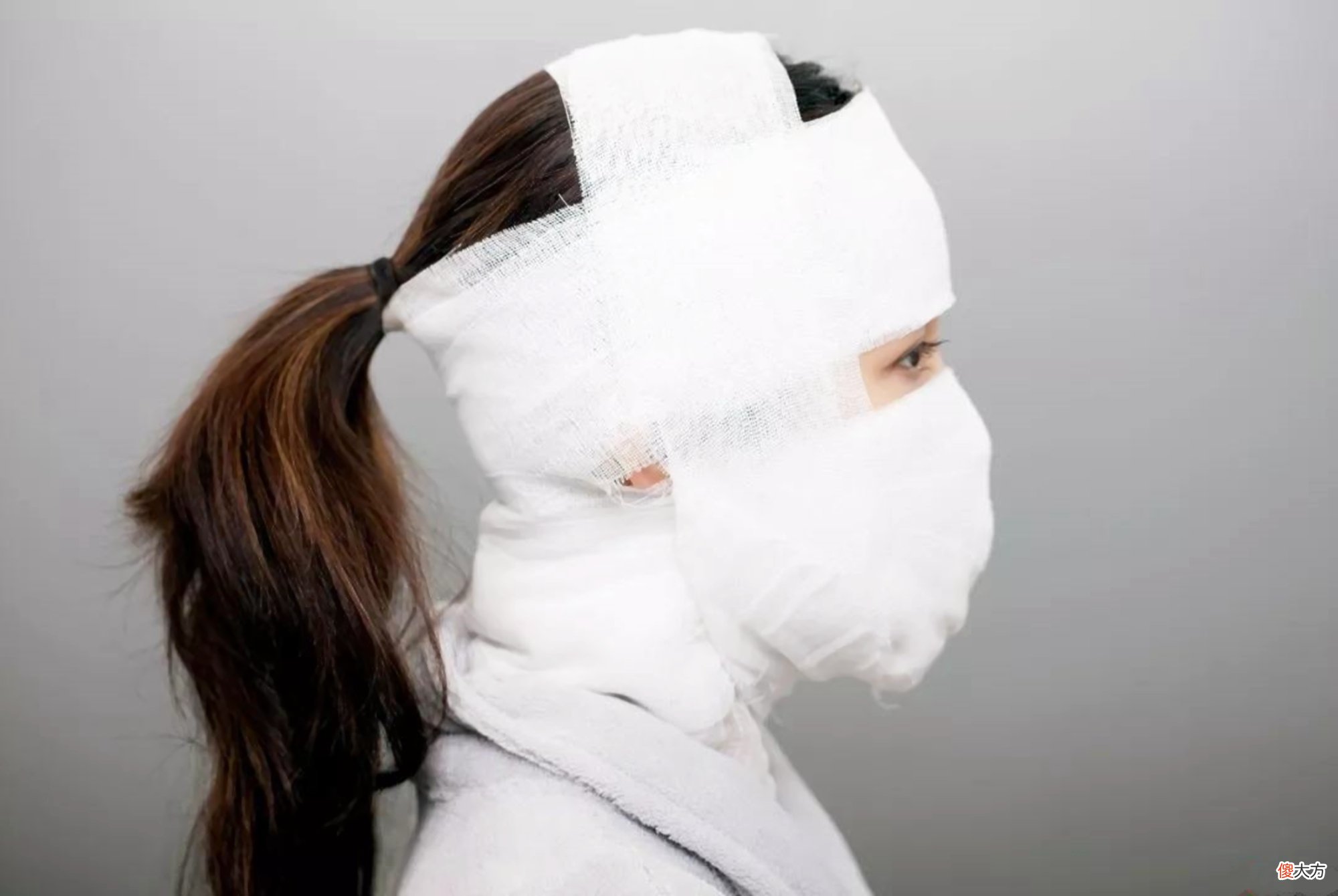 单眼皮女孩在消失？第一批00后成整容“主力军”，背后推手是父母